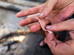 Crevasses aux mains – 3 remèdes de grand-mère Crevasses aux mains