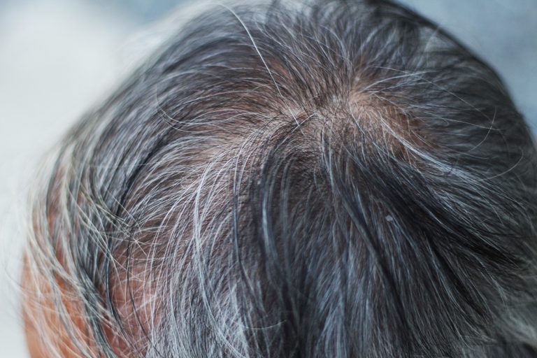 4 astuces pour faire disparaître les cheveux blancs