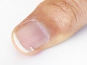 Durcir ses ongles : 5 astuces naturelles de grand-mère durcir les ongles