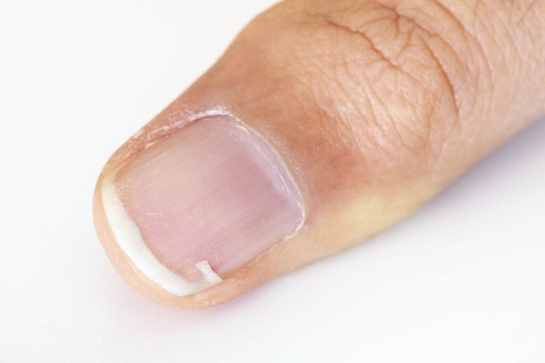 Durcir ses ongles : 5 astuces naturelles de grand-mère