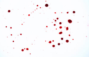 Les meilleures astuces de grands-mères pour enlever des tâches astuces de grands-mères pour enlever des tâches