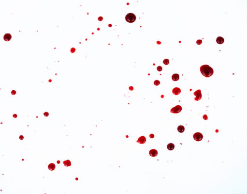 Les meilleures astuces de grands-mères pour enlever des tâches astuces de grands-mères pour enlever des tâches