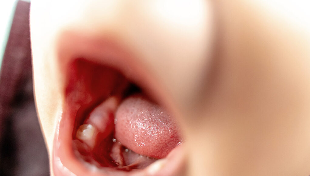 Astuces de grand-mère pour soulager la poussée dentaire de bébé