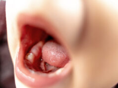 Astuces de grand-mère pour soulager la poussée dentaire de bébé Astuces de grand-mère pour soulager la poussée dentaire de bébé