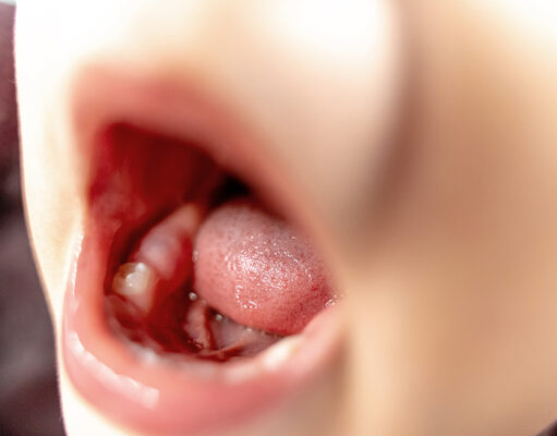 Astuces de grand-mère pour soulager la poussée dentaire de bébé Astuces de grand-mère pour soulager la poussée dentaire de bébé