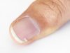 Durcir ses ongles : 5 astuces naturelles de grand-mère durcir les ongles