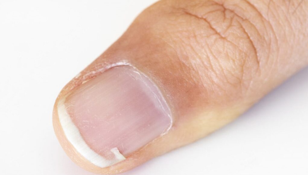 durcir les ongles