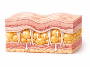 Remèdes de grand-mère pour faire fondre la cellulite faire fondre la cellulite